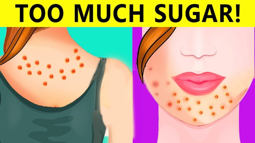 just-7-signs-you-are-eating-too-much-sugar-mkdhealth